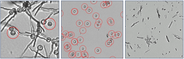 Aspergillus Fumigatusとイトラコナゾール